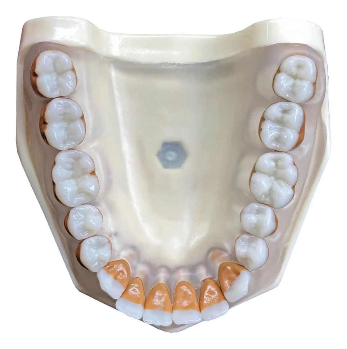 Manequim Periodontia - Orais - Dentalshop